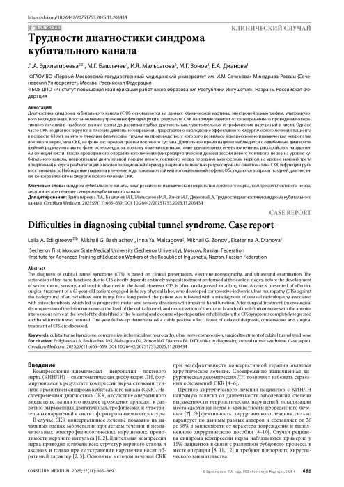 Трудности диагностики синдрома кубитального канала
