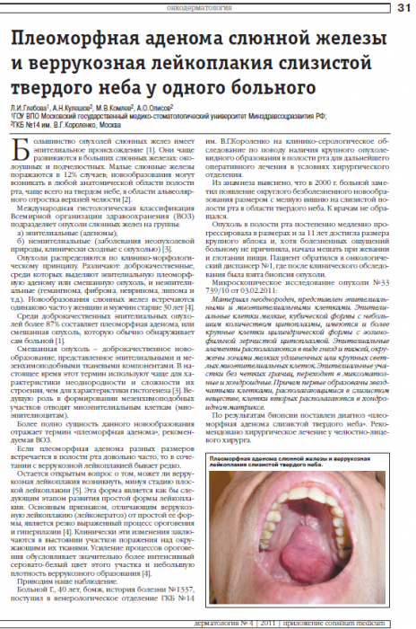 Теория и практический опыт в ультразвуковой диагностике патологии слюнных желез