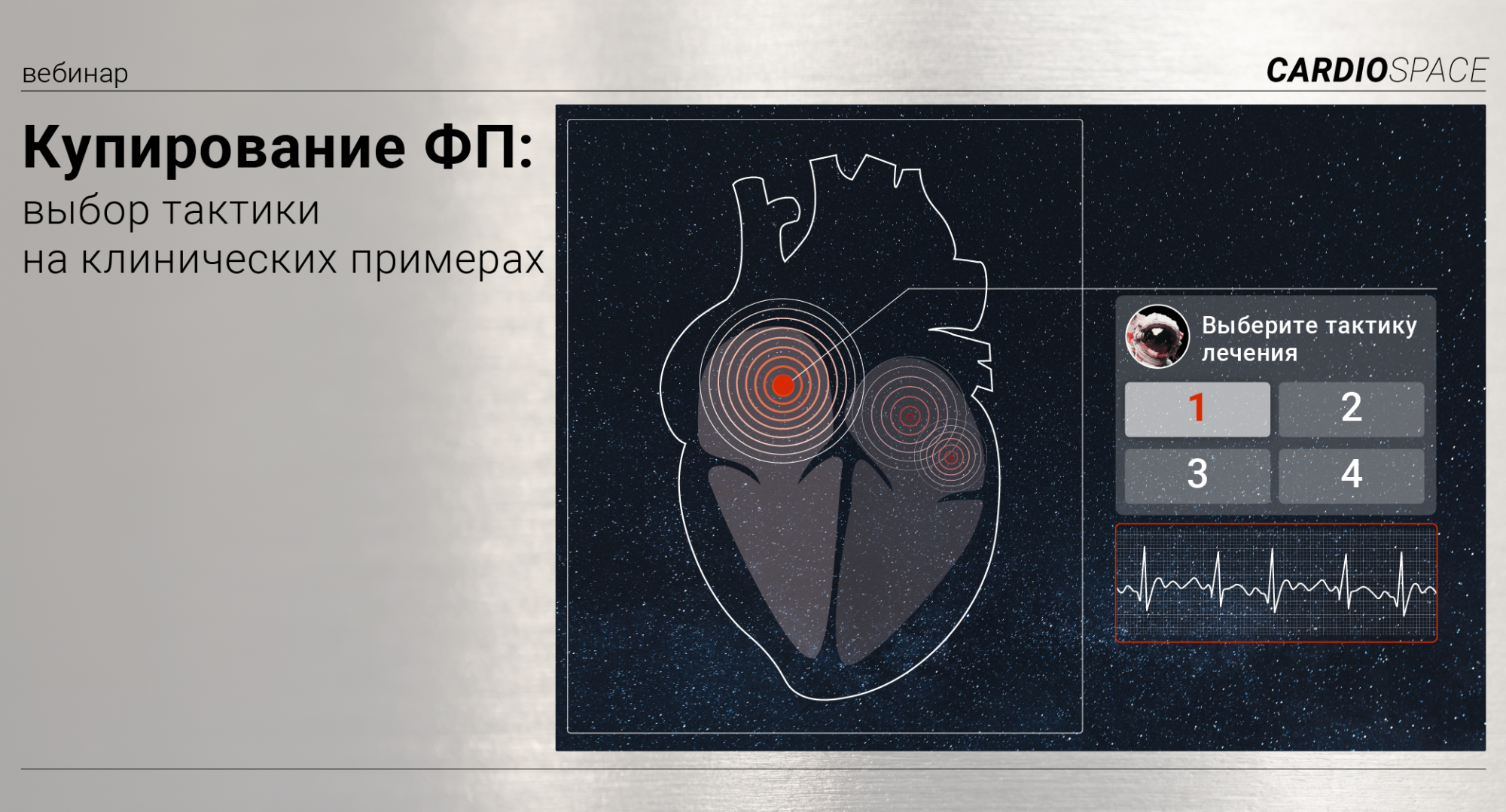 Купирование ФП: выбор тактики на клинических примерах
