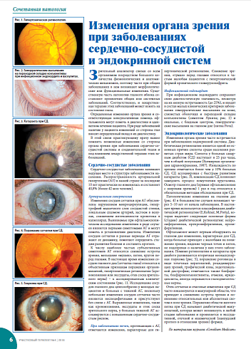 Изменения органа зрения  при заболеваниях сердечно-сосудистой и эндокринной систем