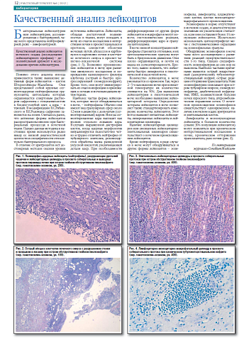 Качественный анализ лейкоцитов