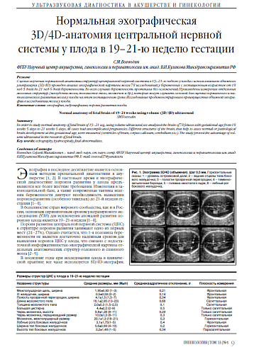 Нормальная эхографическая  3D/4D-анатомия центральной нервной системы у плода в 19–21-ю неделю гестации