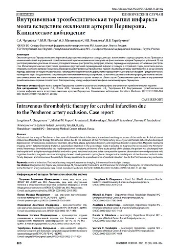 Внутривенная тромболитическая терапия инфаркта мозга вследствие окклюзии артерии Першерона. Клиническое наблюдение