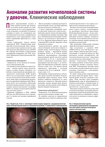 Аномалии развития мочеполовой системы у девочек. Клинические наблюдения