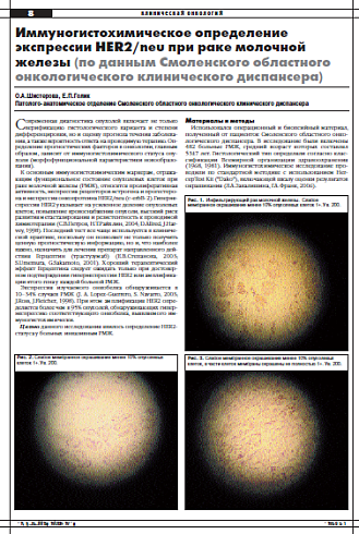 Иммуногистохимическое определение  экспрессии HER2/neu при раке молочной  железы