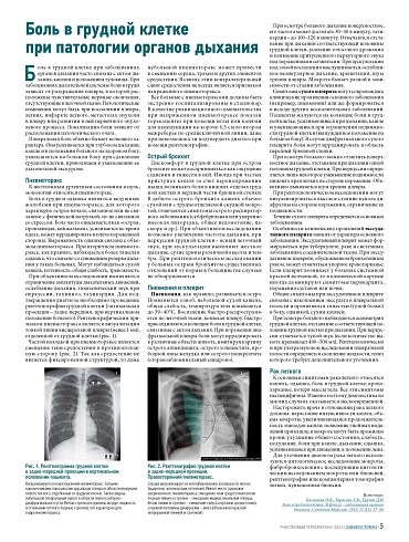 Боль в грудной клетке при патологии органов дыхания