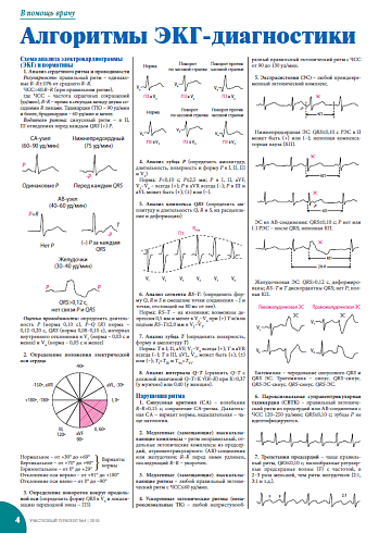 Алгоритмы ЭКГ-диагностики