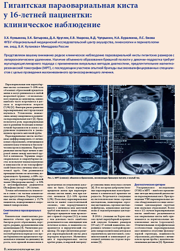 Гигантская параовариальная киста  у 16-летней пациентки:  клиническое наблюдение