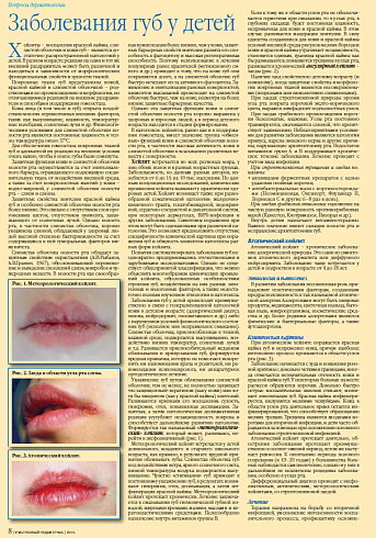 Заболевания губ у детей