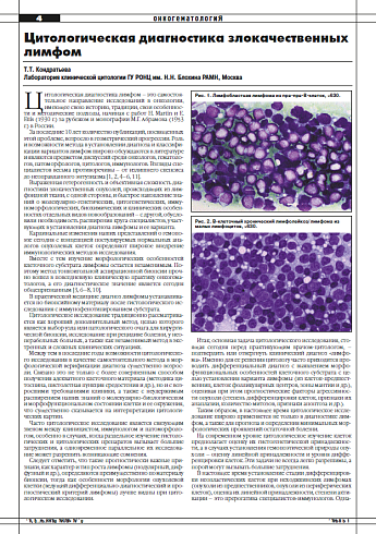 Цитологическая диагностика злокачественных лимфом