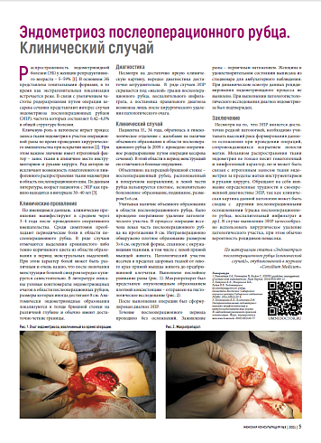 Эндометриоз послеоперационного рубца. Клинический случай