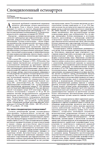 Спондилогенный остеоартроз