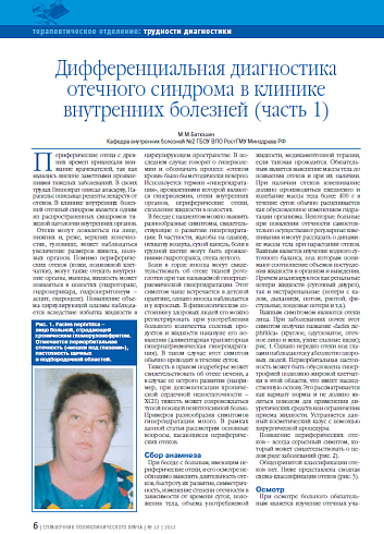 Дифференциальная диагностика отeчного синдрома в клинике внутренних болезней (часть 1)