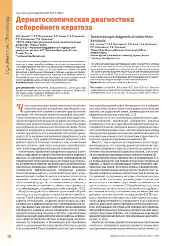 Дерматоскопическая диагностика себорейного кератоза