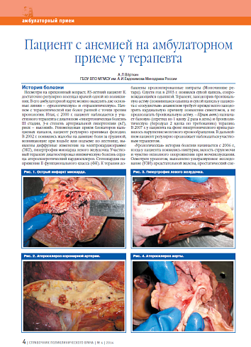 Пациент с анемией на амбулаторном приеме у терапевта