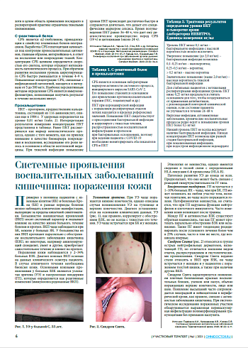 Системные проявления  воспалительных заболеваний кишечника: поражения кожи