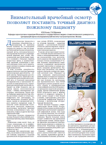 Внимательный врачебный осмотр позволяет поставить точный диагноз пожилому пациенту