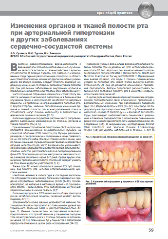 Изменения органов и тканей полости рта при артериальной гипертензии  и других заболеваниях  сердечно-сосудистой системы