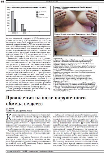 Проявления на коже нарушенного обмена веществ