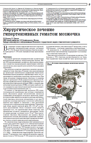 Хирургическое лечение гипертензивных гематом мозжечка