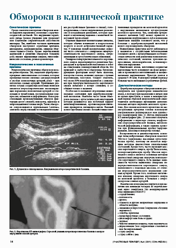 Обмороки в клинической практике