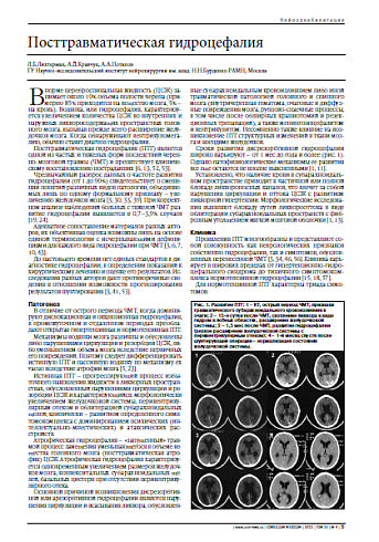 Посттравматическая гидроцефалия