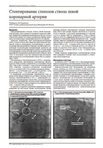 Стентирование стенозов ствола левой коронарной артерии