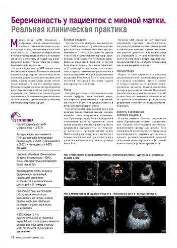 Беременность у пациенток с миомой матки. Реальная клиническая практика