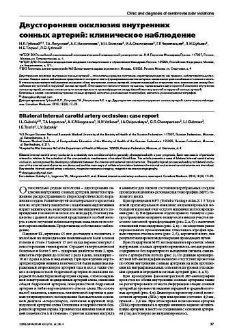 Двусторонняя окклюзия внутренних  сонных артерий: клиническое наблюдение