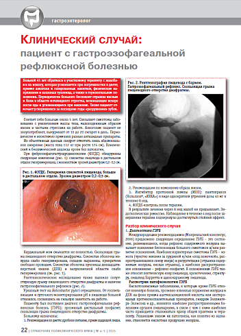 Клинический случай: пациент с гастроэзофагеальной рефлюксной болезнью