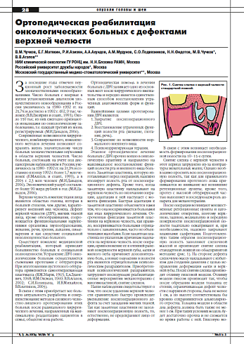 Ортопедическая реабилитация онкологических больных с дефектами  верхней челюсти