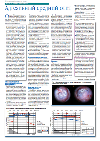Адгезивный средний отит