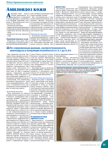 Амилоидоз кожи