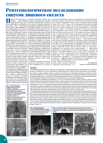 Рентгенологическое исследование синусов лицевого скелета