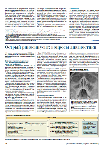 Острый риносинусит: вопросы диагностики