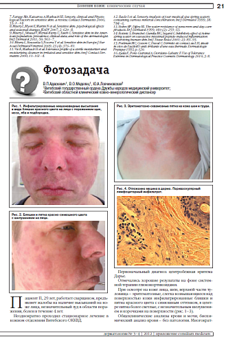 Фотозадача