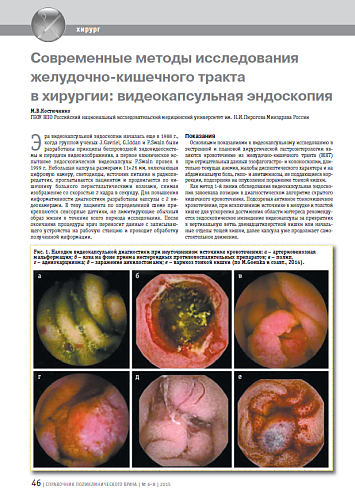 Современные методы исследования желудочно-кишечного тракта в хирургии: видеокапсульная эндоскопия