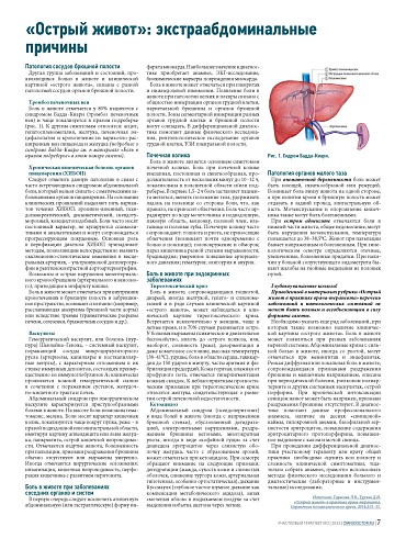 «Острый живот»: экстраабдоминальные причины