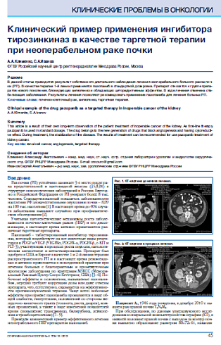 Клинический пример применения ингибитора тирозинкиназ в качестве таргетной терапии при неоперабельном раке почки