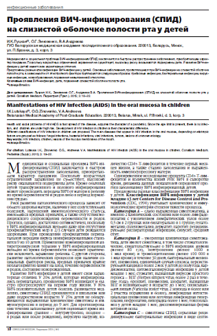 Проявления ВИЧ-инфицирования (СПИД)  на слизистой оболочке полости рта у детей