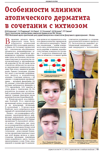 Особенности клиники атопического дерматита  в сочетании с ихтиозом