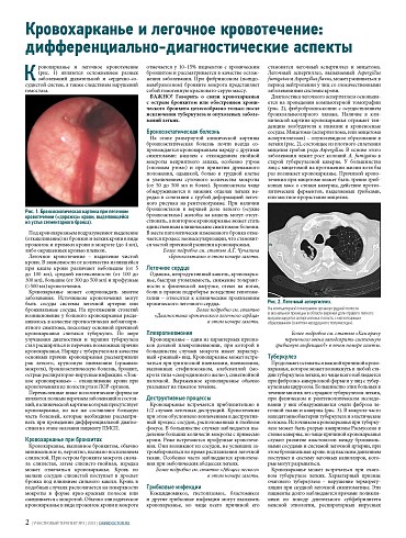 Кровохарканье и легочное кровотечение: дифференциально-диагностические аспекты