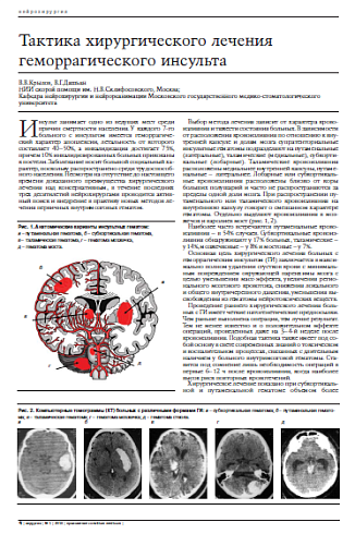 Тактика хирургического лечения геморрагического инсульта