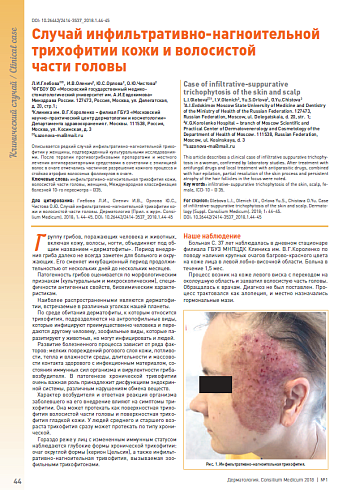 1. Maurer М et al. Unmet clinical needs in chronic spontaneous ur1icaria. А GA2LEN task force report. Allergy 2011; 66 (3): 317-30. 2. Федеральные клинические рекомендации по диагностике и лечению атопического дерматита. РААКИ: М., 2013. http:/ www.nrcii.