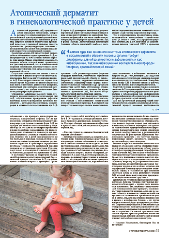 Атопический дерматит в гинекологической практике у детей
