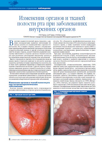 Изменения органов и тканей полости рта при заболеваниях внутренних органов