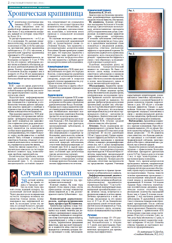 Хроническая крапивница