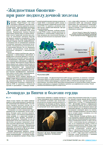 «Жидкостная биопсия»  при раке поджелудочной железы