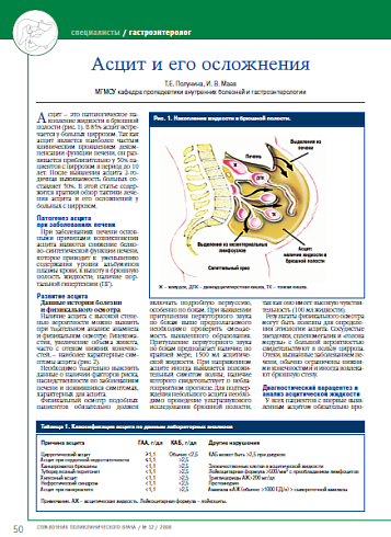 Асцит и его осложнения