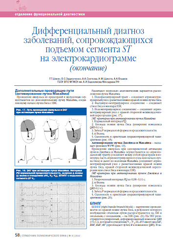 Дифференциальный диагноз заболеваний, сопровождающихся подъемом сегмента ST на электрокардиограмме (окончание)